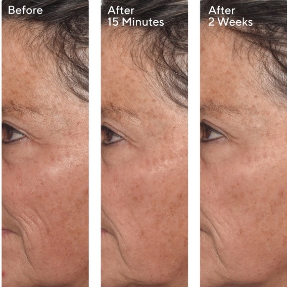 Murad Targeted Wrinkle Corrector - Picture 3 of 3